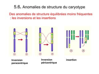 5.6 .  Anomalies de structure du caryotype Des anomalies de structure équilibrées moins fréquentes  : les inversions et les insertions Inversion paracentrique insertion Inversion péricentrique 