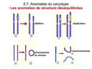 5.7. Anomalies du caryotype :  Les anomalies de structure déséquilibrées   délétion duplication chromosome en anneau isochromosome 