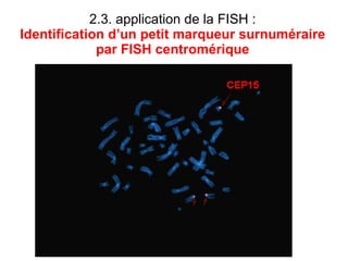 2.3. application de la FISH : Identification d’un petit marqueur surnuméraire par   FISH centromérique 