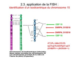 2.3. application de la FISH : identification d’un isodicentrique du chromosome 15 CEP 15 CEP 15 SNRPN, D15S10 SNRPN, D15S10 47,XX,+idic(15;15)(q13;q13).ish15q11-q13 (SNRPN++,D15S10++) 