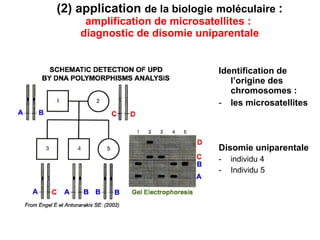 (2) application  de la biologie   moléculaire  :  amplification de microsatellites :  diagnostic de disomie uniparentale Identification de l’origine des chromosomes : les microsatellites Disomie uniparentale   individu 4 Individu 5 