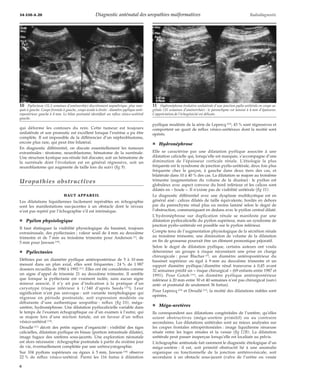 34-550-A-20 Diagnostic anténatal des uropathies malformatives Radiodiagnostic 
qui déforme les contours du rein. Cette tumeur est toujours 
unilatérale et son pronostic est excellent lorsque l’exérèse a pu être 
complète. Il est impossible de la différencier d’un néphroblastome, 
encore plus rare, qui peut être bilatéral. 
En diagnostic différentiel, on discute essentiellement les tumeurs 
extrarénales : tératome, neuroblastome, hématome de la surrénale. 
Une structure kystique sus-rénale fait discuter, soit un hématome de 
la surrénale dont l’évolution est en général régressive, soit un 
neuroblastome qui augmente de taille lors du suivi (fig 9). 
Uropathies obstructives 
HAUT APPAREIL 
Les dilatations liquidiennes facilement repérables en échographie 
sont les manifestations sus-jacentes à un obstacle dont le niveau 
n’est pas repéré par l’échographie s’il est intrinsèque. 
¦ Pyélon physiologique 
Il faut distinguer la visibilité physiologique du bassinet, toujours 
extrasinusale, des pyélectasies ; valeur seuil de 4 mm au deuxième 
trimestre et de 7 mm au troisième trimestre pour Anderson [1], de 
5 mm pour Jawson [18]. 
¦ Pyélectasies 
Définies par un diamètre pyélique antéropostérieur de 5 à 10mm 
mesuré dans un plan axial, elles sont fréquentes : 24 % de 1 987 
dossiers recueillis de 1980 à 1992 [11]. Elles ont été considérées comme 
un signe d’appel de trisomie 21 au deuxième trimestre. Il semble 
que lorsque la pyélectasie est vraiment isolée, sans aucun signe 
mineur associé, il n’y ait pas d’indication à la pratique d’un 
caryotype (risque inférieur à 1/340 d’après Seeds [25]). Leur 
signification n’est pas univoque : soit variante morphologique qui 
régresse en période postnatale, soit expression modérée ou 
débutante d’une authentique uropathie : reflux (fig 10), méga-uretère, 
hydronéphrose. Une dilatation pyélocalicielle variable dans 
le temps de l’examen échographique ou d’un examen à l’autre, qui 
se majore lors d’une miction foetale, est en faveur d’un reflux 
vésico-urétéral [14]. 
Droullé [11] décrit des petits signes d’organicité : visibilité des tiges 
calicielles, dilatation pyélique en bissac (portion intrarénale dilatée), 
image fugace des uretères sous-jacents. Une exploration néonatale 
est alors nécessaire : échographie postnatale à partir du sixième jour 
de vie, éventuellement complétée par une urétrocystographie. 
Sur 104 pyélons supérieurs ou égaux à 5 mm, Jawson [18] observe 
22 % de reflux vésico-urétéral. Parmi les 116 foetus à dilatation 
pyélique modérée de la série de Lepercq [23], 43 % sont régressives et 
comportent un quart de reflux vésico-urétéraux dont la moitié sont 
opérés. 
¦ Hydronéphrose 
Elle se caractérise par une dilatation pyélique associée à une 
dilatation calicielle qui, lorsqu’elle est marquée, s’accompagne d’une 
diminution de l’épaisseur corticale rénale. L’étiologie la plus 
fréquente est le syndrome de jonction pyélo-urétérale, deux fois plus 
fréquente chez le garçon, à gauche dans deux tiers des cas, et 
bilatérale dans 10 à 40 % des cas. La dilatation se majore au troisième 
trimestre (augmentation du volume de la diurèse) : le pyélon est 
globuleux avec aspect convexe du bord inférieur et les calices sont 
dilatés en « boule ». Il n’existe pas de visibilité urétérale (fig 11). 
Le diagnostic différentiel avec une dysplasie multikystique est en 
général aisé : calices dilatés de taille équivalente, bordés en dehors 
par du parenchyme rénal plus ou moins laminé selon le degré de 
l’obstruction, communiquant en dedans avec le pyélon central dilaté. 
L’hydronéphrose sur duplication rénale se manifeste par une 
dilatation pyélocalicielle du pyélon supérieur, mais un syndrome de 
jonction pyélo-urétérale est possible sur le pyélon inférieur. 
Compte tenu de l’augmentation physiologique de la sécrétion rénale 
au troisième trimestre, une diminution de volume de la dilatation 
en fin de grossesse pourrait être un élément pronostique péjoratif. 
Selon le degré de dilatation pyélique, certains auteurs ont voulu 
déterminer un groupe à risque nécessitant une prise en charge 
chirurgicale : pour Blachar [5], un diamètre antéropostérieur du 
bassinet supérieur ou égal à 9 mm au deuxième trimestre et un 
rapport diamètre pyélique/diamètre rénal transverse à 0,45 avant 
32 semaines prédit un « risque chirurgical » (69 enfants entre 1987 et 
1991). Pour Gotoh [16], un diamètre pyélique antéropostérieur 
inférieur à 20 mm entre 30 et 40 semaines n’est pas chirurgical (suivi 
anté- et postnatal de seulement 36 foetus). 
Pour Lepercq [23] et Droullé [11], la moitié des dilatations stables sont 
opérées. 
¦ Méga-uretères 
Ils correspondent aux dilatations congénitales de l’uretère, qu’elles 
soient obstructives (méga-uretère primitif) ou au contraire 
secondaires. Les dilatations urétérales sont au mieux analysées sur 
les coupes frontales rétropéritonéales : image liquidienne sinueuse 
située entre les loges rénales et la vessie (fig 12B). La dilatation 
urétérale peut passer inaperçue lorsqu’elle est localisée au pelvis. 
L’échographie anténatale fait rarement le diagnostic étiologique d’un 
méga-uretère : il est, soit primitif obstructif lié à une anomalie 
organique ou fonctionnelle de la jonction urétérovésicale, soit 
secondaire à un obstacle sous-jacent (valve de l’urètre ou vessie 
10 Pyélectasie (31,5 semaines d’aménorrhée) discrètement asymétrique, plus mar-quée 
à gauche. Coupe frontale à gauche, coupe axiale à droite : diamètre pyélique anté-ropostérieur 
gauche à 8 mm. Le bilan postnatal identifiait un reflux vésico-urétéral 
gauche. 
11 Hydronéphrose évolutive unilatérale d’une jonction pyélo-urétérale en coupe sa-gittale 
(35 semaines d’aménorrhée) : le parenchyme est laminé à 4 mm d’épaisseur. 
L’appréciation de l’échogénicité est délicate. 
6 
 