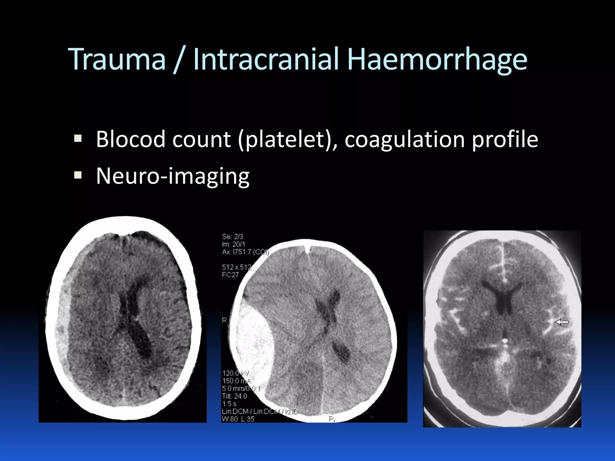 Diagnostic approach to acute encephalopathy | PDF