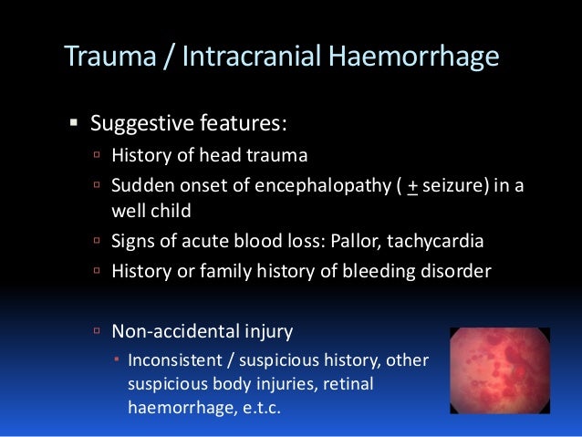 acute encephalopathy