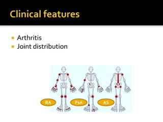 Diagnostic approach to musculoskeletal pain | PDF