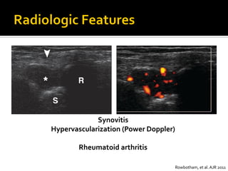 Diagnostic approach to musculoskeletal pain | PDF