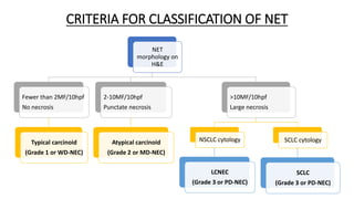 Nec Classification Radiology Diagnostic approach to neuroendocrine tumors of lung | PPTX
