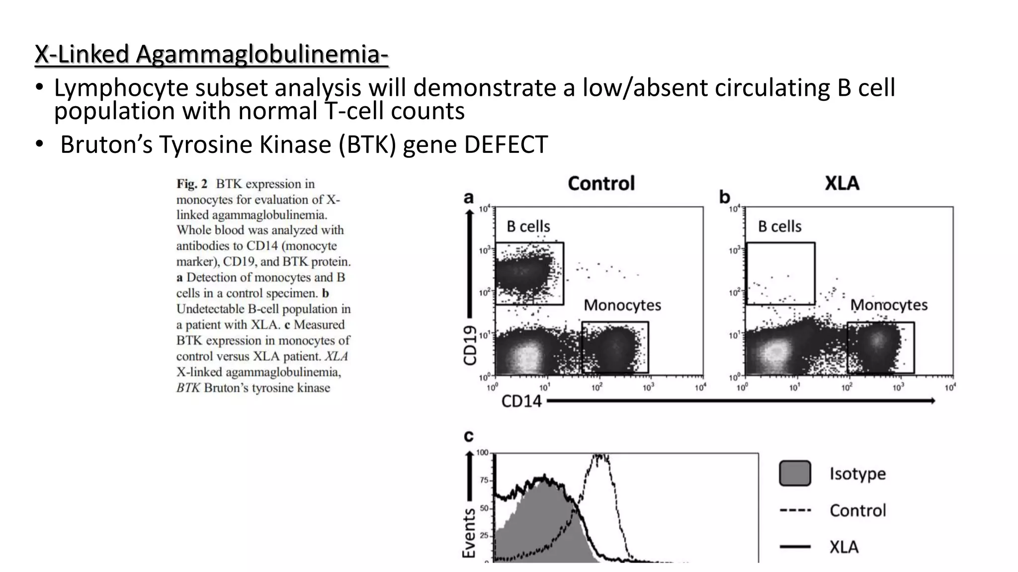 X-Linked Agammaglobulinemia-
• Lymphocyte subset analysis will demonstrate a low/absent circulating B cell
population with normal T-cell counts
• Bruton’s Tyrosine Kinase (BTK) gene DEFECT
 