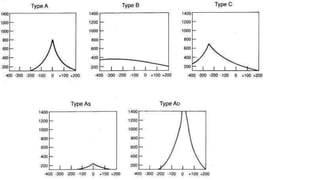 diagnostic audiology, audiometry, tympanometry and OAE.pptx