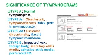 Typanogram Types Normal diagnostic audiology, audiometry, tympanometry and OAE.pptx