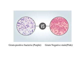 Gram-positive bacteria (Purple) Gram Negative stain(Pink)
 