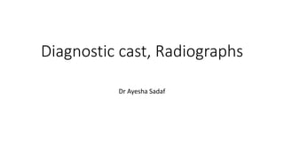 Diagnostic cast, Radiographs
Dr Ayesha Sadaf
 