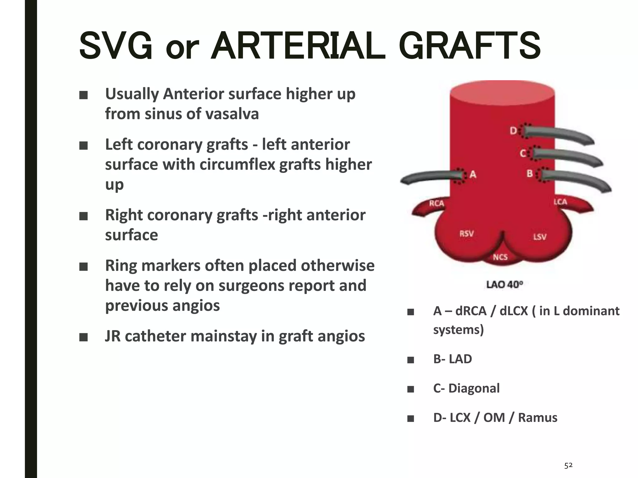 Diagnostic catheters for coronary angiography | PPTX