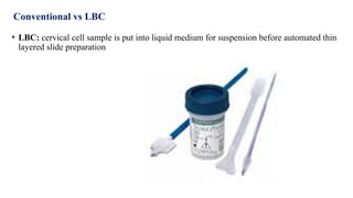 Lbc Testing Diagnostic Cytology Diagnostic CytologyDiagnostic CytologyDiagnostic ...