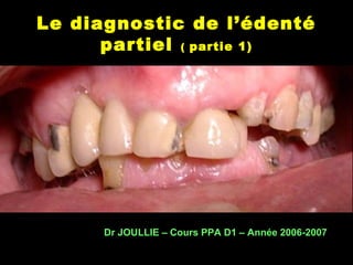 Le diagnostic de l’édenté
partiel ( partie 1)
Dr JOULLIE – Cours PPA D1 – Année 2006-2007
 