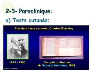 2-3- Paraclinique:
a) Tests cutanés:
 