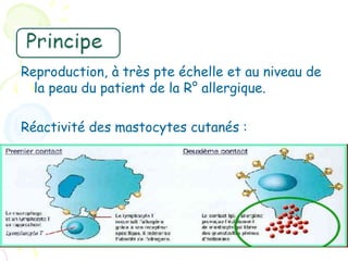 Reproduction, à très pte échelle et au niveau de
  la peau du patient de la R° allergique.

Réactivité des mastocytes cutanés :
 