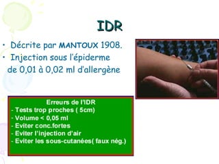 IDR
• Décrite par MANTOUX 1908.
• Injection sous l’épiderme
 de 0,01 à 0,02 ml d’allergène
 