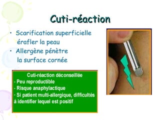 Cuti-réaction
• Scarification superficielle
  érafler la peau
• Allergène pénètre
  la surface cornée
 