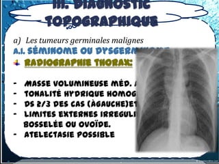 III. Diagnostic
       topographique
a) Les tumeurs germinales malignes
a.1. séminome ou dysgerminome
    Radiographie thorax:

- Masse volumineuse méd. ant/moyen
- tonalité hydrique homogène
- Ds 2/3 des cas (àGauche)et unilateral
- Limites externes irregulières,
  bosselée ou ovoïde.
- Atelectasie possible
 