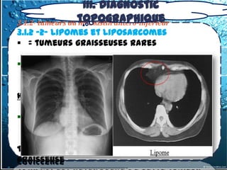 III. Diagnostic
3.1.2- tumeurs du topographique
                  médiastin antero-inférieur
3.1.2 -2- lipomes et liposarcomes
 = tumeurs graisseuses rares

 Le lipome: Tumeur bénigne pouvant
   refouler médiastin et poumons
  TDM: Confirme le caractère graisseux
homogène.

 Liposarcome: Tumeur maligne rare
  volumineuse souvent encapsulée
  asymptomatique
TDM: Aspect hétérogène de cette tumeur
graisseuse
 