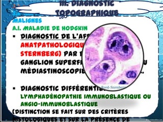 III. Diagnostic
3.2- tumeurs du médiastin Moyen
               topographique
3.2 -2.1. Adénopathies médiastinales
Malignes
A.1. Maladie de hodgkin
 Diagnostic de l'affection :
  anatpathologique(cellule reed
  sternberg) par biopsie d'un
  ganglion superficiel (cervical),ou
  médiastinoscopie ,thoracotomie.

 Diagnostic différentiel : la
   lymphadénopathie immunoblastique ou
   angio-immunoblastique
(distinction se fait sur des critères
histologiques et sur la présence de
 