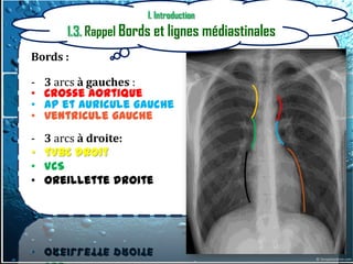 I. Introduction
       1.3. Rappel Bords et lignes médiastinales
Bords :

-   3 arcs à gauches :
•   Crosse aortique
•   AP et auricule gauche
•   ventricule gauche
-   3 arcs à droite:
•   TVBC droit
•   VCS
•   oreillette droite
 