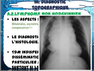 III. Diagnostic
3.2 -2.1. Adénopathies médiastinales
Malignes       topographique
A.2.Lymphome non hodgkinnien
 Les aspects radiologiques ADP
  Bilatérales, asymétriques, volumineuses+++,
  compressives+/-


 Le diagnostic repose ici encore sur
  l'histologie.

 TDM indispensable au bilan de la
  dissémination de la maladie, en
  particulier à l'étage thoracique,
  surtout si les radiographies
 