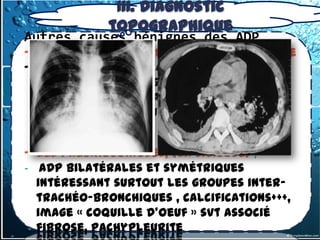 III. Diagnostic
             topographique
Autres causes bénignes des ADP
- L'hyperplasie lympho-angio-réticulaire
- décrite par Castleman, d'étiologie
  inconnue et de diagnostic histologique,
  affection rare , masse médiastinale ou
  hilaire hypervasculaire


- les pneumoconioses, (la silicose) ,
- ADP bilatérales et symétriques
  intéressant surtout les groupes inter-
  trachéo-bronchiques , calcifications+++,
  image « coquille d'oeuf » svt associé
  fibrose, pachypleurite
 