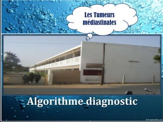 Les Tumeurs
          médiastinales




Algorithme diagnostic
 