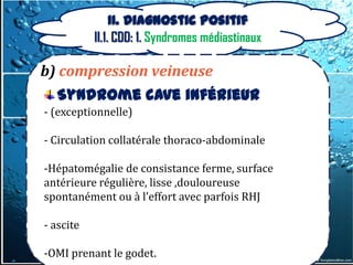 II. Diagnostic positif
           II.1. CDD: 1. Syndromes médiastinaux

b) compression veineuse
  Syndrome cave inférieur
- (exceptionnelle)

- Circulation collatérale thoraco-abdominale

-Hépatomégalie de consistance ferme, surface
antérieure régulière, lisse ,douloureuse
spontanément ou { l’effort avec parfois RHJ

- ascite

-OMI prenant le godet.
 