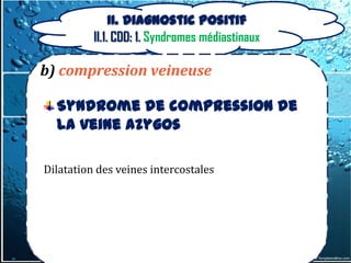 II. Diagnostic positif
          II.1. CDD: 1. Syndromes médiastinaux

b) compression veineuse

  Syndrome de compression de
  la veine azygos

Dilatation des veines intercostales
 