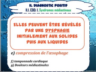 II. Diagnostic positif
         II.1. CDD: 1. Syndromes médiastinaux

a) compression trachéale ou bronchique
  Elles peuvent être révélés
b) compression veineuse
         par une dysphagie
     initialement aux solides
c) compression du canal thoracique

          puis aux liquides
d) atteintes nerveuses

e) compression de l’œsophage
f) tamponnade cardiaque
g) Douleurs médiastinales
 