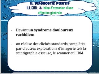 II. Diagnostic positif
         II.1. CDD: 2. bilan d'extension d'une
                   affection générale


- Lorsqu’on suspecte une localisation
- Devant un syndrome douloureux
  médiastinale d’une affection à tropisme
   rachidien:
  ganglionnaire: lymphopathie,
  tuberculose(PIT), sarcoïdose… après
- on réalise des clichés standards complétés
  découverte des signes { l’examen
   par d'autres explorations d'imagerie tels la
  physique(adénopathie viscérale ou cutanée,
   scintigraphie osseuse, le scanner et l'IRM
  signes oculaire…)
 