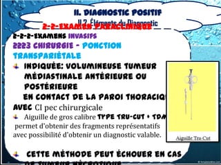 II. Diagnostic positif
                  II.2. Éléments du Diagnostic
         2-2-Examen Paraclinique
2-2-2-Examens invasifs
2223 CHIRURGIE – Ponction
transpariétale
   Indiquée: volumineuse tumeur
   médiastinale antérieure ou
   postérieure
  en contact de la paroi thoracique
avec CI pec chirurgicale
   Aiguille de gros calibre type Tru-Cut + TDM
permet d'obtenir des fragments représentatifs
avec possibilité d'obtenir un diagnostic valable.

    Cette méthode peut échouer en cas
 