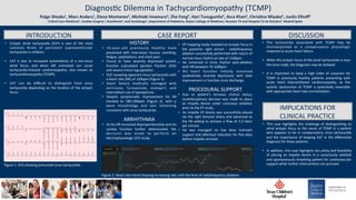 Page 1
Diagnos(c	Dilemma	in	Tachycardiomyopathy	(TCMP)		
Paige	Sheaks1,	Marc	Anders1,	Elena	Montanes2,	Michiaki	Imamura3,	Zhe	Fang4,	Hari	Tunuguntla5,	Asra	Khan5,	ChrisDna	Miyake5,	JusDn	Elhoﬀ1	
CriDcal	Care	Medicine1,	Cardiac	Surgery3,	Anesthesia4,	and	Cardiology5,	Department	of	Pediatrics,	Baylor	College	of	Medicine,	Houston	TX	and	Hospital	12	de	Octubre2,	Madrid	Spain	
INTRODUCTION	 CASE	REPORT	 DISCUSSION	
•  Ectopic	 atrial	 tachycardia	 (EAT)	 is	 one	 of	 the	 most	
common	 forms	 of	 persistent	 supraventricular	
tachycardia	in	children.	
	
•  EAT	 is	 due	 to	 increased	 automa(city	 of	 a	 non-sinus	
atrial	 focus,	 and	 when	 leI	 untreated	 can	 cause	
tachycardia-induced	 cardiomyopathy,	 also	 known	 as	
tachycardiomyopathy	(TCMP).	
	
•  EAT	 can	 be	 diﬃcult	 to	 dis(nguish	 from	 sinus	
tachycardia	depending	on	the	loca(on	of	the	ectopic	
focus.		
HISTORY	
•  16-year-old	 previously	 healthy	 male	
presented	 with	 new-onset	 nausea,	 vomi(ng,	
fa(gue,	palpita(ons,	and	chest	pain.		
•  Found	 to	 have	 severely	 depressed	 systolic	
func(on	 (calculated	 ejec(on	 frac(on	 22%)		
and	severe	mitral	regurgita(on.		
•  ECG	revealing	apparent	sinus	tachycardia	with	
a	heart	rate	(HR)	of	120bpm	(Figure	1).		
•  Heart	 failure	 medically	 managed	 with	
milrinone,	 furosemide,	 enalapril,	 and	
intermiWent	use	of	epinephrine.		
•  Despite	 symptoma(c	 improvement	 his	 HR	
trended	 to	 180-190bpm	 (Figure	 2),	 with	 p	
wave	 morphology	 and	 axis	 remaining	
consistent	with	sinus	tachycardia.		
	
ARRHYTHMIA	
•  As	his	HR	increased	dispropor(onately	and	his	
cardiac	 func(on	 further	 deteriorated,	 the	
decision	 was	 made	 to	 perform	 an	
electrophysiologic	(EP)	study.	
	
•  EP	mapping	study	revealed	an	ectopic	focus	in	
the	 posterior	 right	 atrium	 -	 radiofrequency	
abla(on	successfully	performed	with	return	of	
normal	sinus	rhythm	at	rate	of	110bpm.		
•  He	 remained	 in	 sinus	 rhythm	 post-abla(on	
with	HR	between	70-100bpm	
•  His	 heart	 func(on	 ini(ally	 remained	
qualita(vely	 severely	 depressed,	 with	 slow	
improvement	in	func(on	since	discharge.	
	
PROCEDURAL	SUPPORT	
•  Due	 to	 pa(ent’s	 tenuous	 clinical	 status,	
mul(disciplinary	 decision	 was	 made	 to	 place	
an	 Impella	 device	 under	 conscious	 seda(on	
prior	to	the	EP	study.	
•  An	Impella	CP	device	was	successfully	placed	
via	the	right	femoral	artery	and	advanced	to	
the	 P8	 se_ng	 to	 achieve	 a	 ﬂow	 of	 3.3	 liters	
per	minute.	
•  He	 was	 managed	 on	 low	 dose	 inotropic	
support	and	aIerload	reduc(on	for	ﬁve	days	
before	Impella	removal.		
	
		
•  The	 tachycardia	 associated	 with	 TCMP	 may	 be	
misinterpreted	 as	 a	 compensatory	 physiologic	
response	to	acute	heart	failure.		
	
•  When	the	ectopic	focus	of	the	atrial	tachycardia	is	near	
the	sinus	node,	the	diagnosis	may	be	delayed.		
	
•  It	 is	 important	 to	 keep	 a	 high	 index	 of	 suspicion	 for	
TCMP	 in	 previously	 healthy	 pa(ents	 presen(ng	 with	
acute	 heart	 failure/dilated	 cardiomyopathy,	 as	 the	
systolic	 dysfunc(on	 of	 TCMP	 is	 poten(ally	 reversible	
with	appropriate	heart	rate	normaliza(on.		
IMPLICATIONS	FOR		
CLINICAL	PRACTICE	
•  This	 case	 highlights	 the	 challenge	 of	 dis(nguishing	 an	
atrial	ectopic	focus	as	the	cause	of	TCMP	in	a	pa(ent	
who	 appears	 to	 be	 in	 compensatory	 sinus	 tachycardia	
and	 the	 importance	 of	 keeping	 EAT	 in	 the	 diﬀeren(al	
diagnosis	for	these	pa(ents.		
	
•  In	addi(on,	this	case	highlights	the	u(lity	and	feasibility	
of	 placing	 an	 Impella	 device	 in	 a	 consciously	 sedated	
and	spontaneously	breathing	pa(ent	for	cardiovascular	
support	while	further	interven(ons	are	pursued.		Figure	1.	ECG	showing	presumed	sinus	tachycardia.		
Figure	2.	Heart	rate	trend	showing	increasing	rate	un(l	the	(me	of	radiofrequency	abla(on.	
 