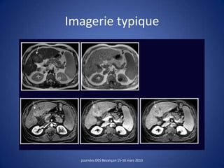Imagerie typique
journées DES Besançon 15-16 mars 2013
 