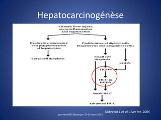 Hepatocarcinogénèse
journées DES Besançon 15-16 mars 2013
Libbrecht L et al. Liver Int. 2005
 