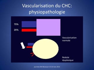 Vascularisation du CHC:
physiopathologie
journées DES Besançon 15-16 mars 2013
Nodule
dysplasique
Vascularisation
normale
 