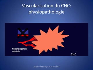 Vascularisation du CHC:
physiopathologie
journées DES Besançon 15-16 mars 2013
CHC
 