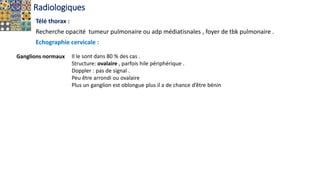 Radiologiques
Télé thorax :
Recherche opacité tumeur pulmonaire ou adp médiatisnales , foyer de tbk pulmonaire .
Echographie cervicale :
Ganglions normaux Il le sont dans 80 % des cas .
Structure: ovalaire , parfois hile périphérique .
Doppler : pas de signal .
Peu être arrondi ou ovalaire
Plus un ganglion est oblongue plus il a de chance d’être bénin
 