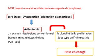 2-CAT devant une adénopathie cervicale suspecte de lymphome
1ére étape: Cytoponction (orientation diagnostique )
Adénotomie
Un examen histologique conventionnel la clonalité de la prolifération
Examen immunohistochimique Sous type de l’hémopathie
PCR (EBV)
Prise en charge
 