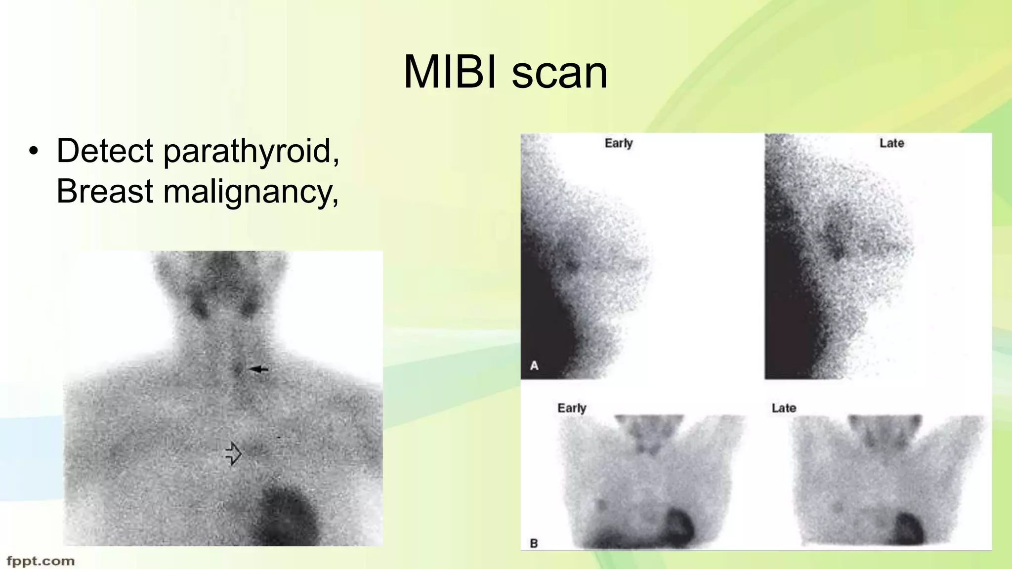 diagnostic evaluation for malignent disease.pptx