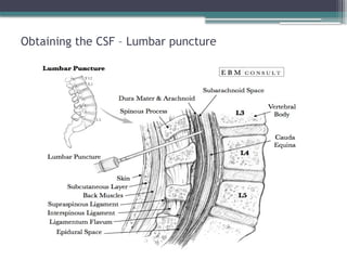 Obtaining the CSF – Lumbar puncture
 