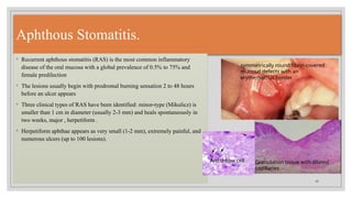 Major Ras Diagnostic Features of Common Oral Ulcerative Lesions.pptx