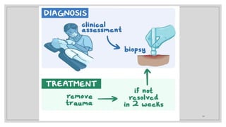 Diagnostic Features of Common Oral Ulcerative Lesions.pptx