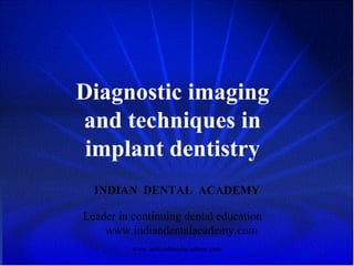 Diagnostic imaging
and techniques in
implant dentistry
INDIAN DENTAL ACADEMY
Leader in continuing dental education
www.indiandentalacademy.com
www.indiandentalacademy.com
 