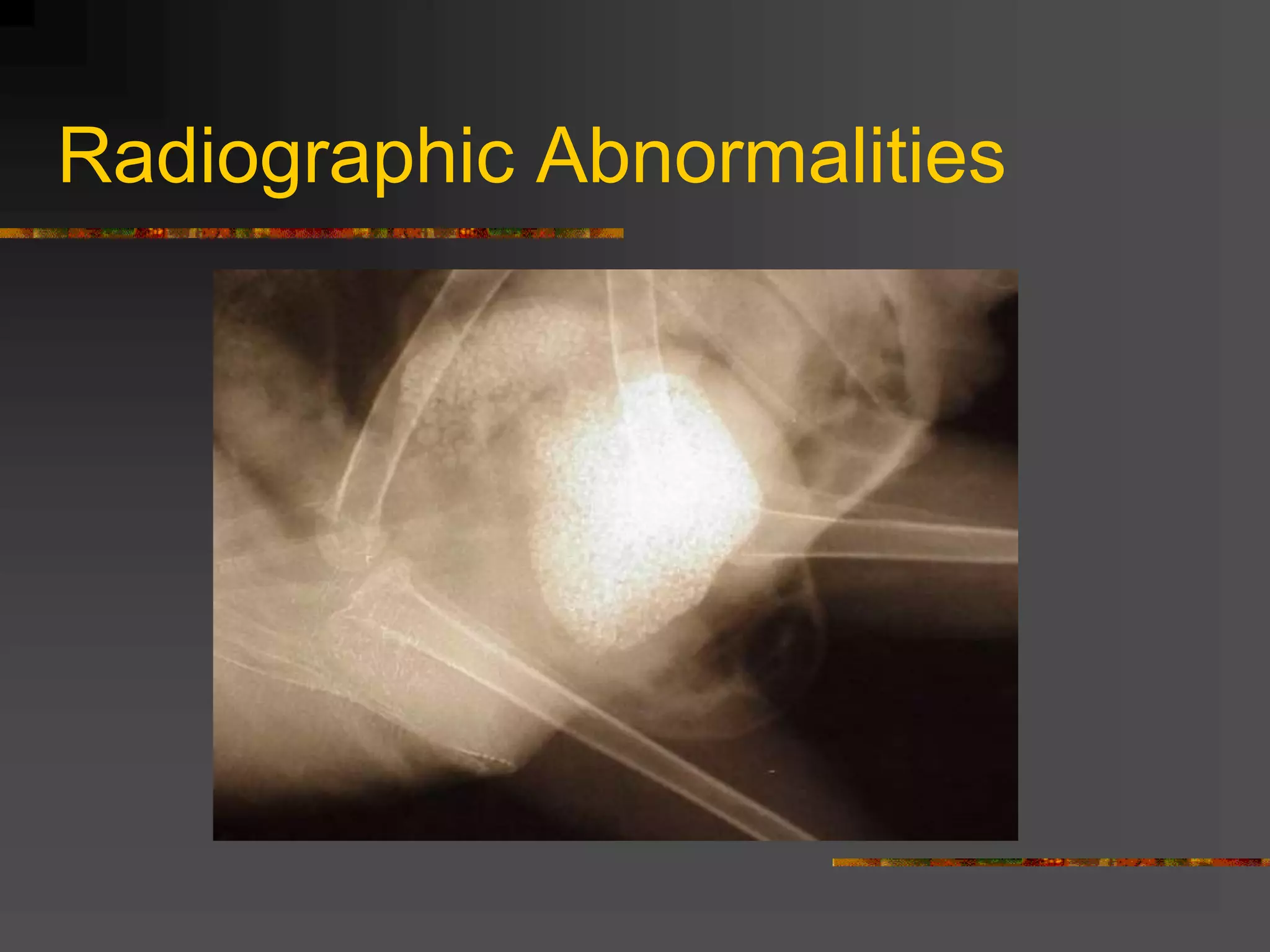 Radiographic Abnormalities
 