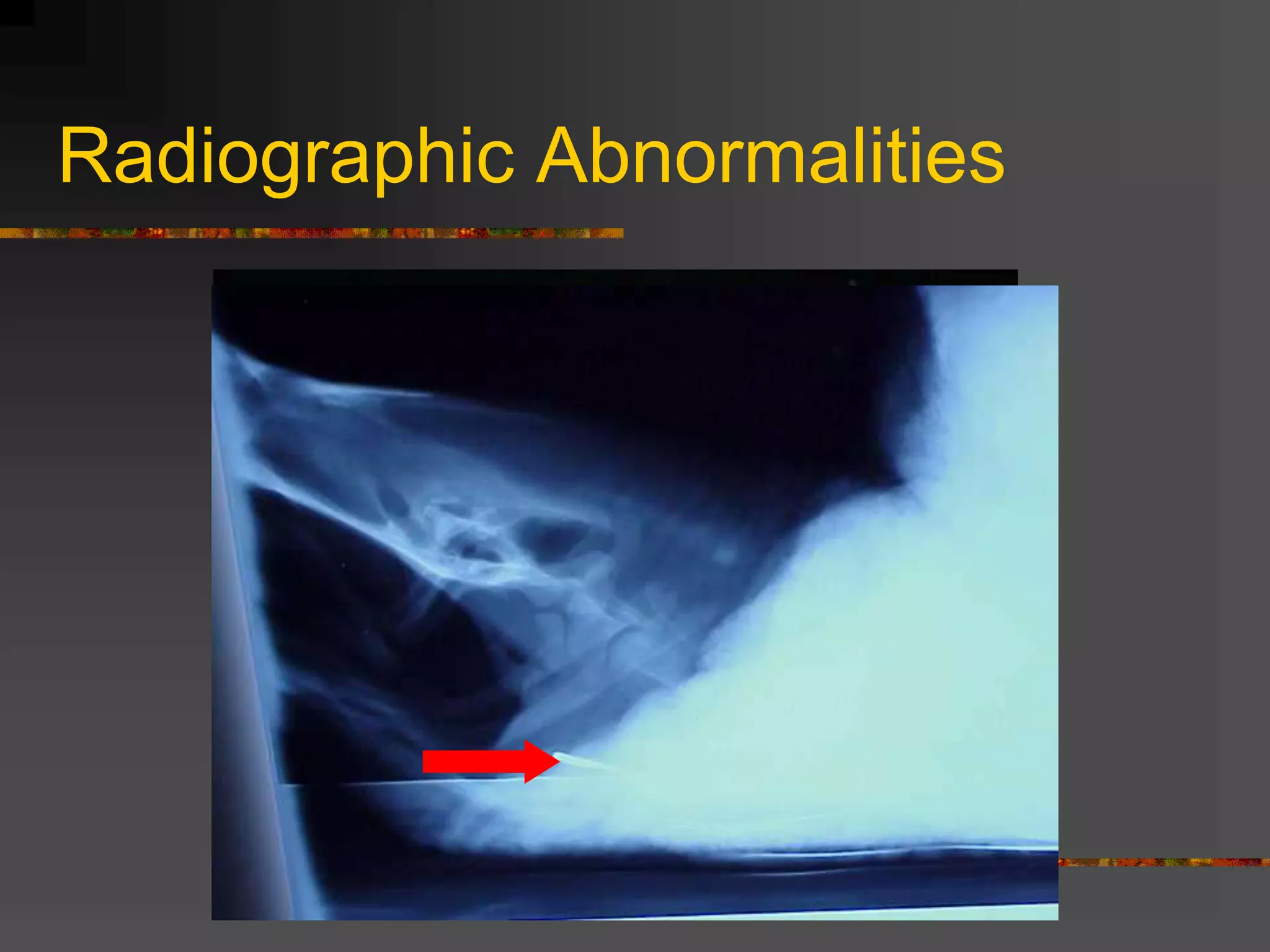 Radiographic Abnormalities
 