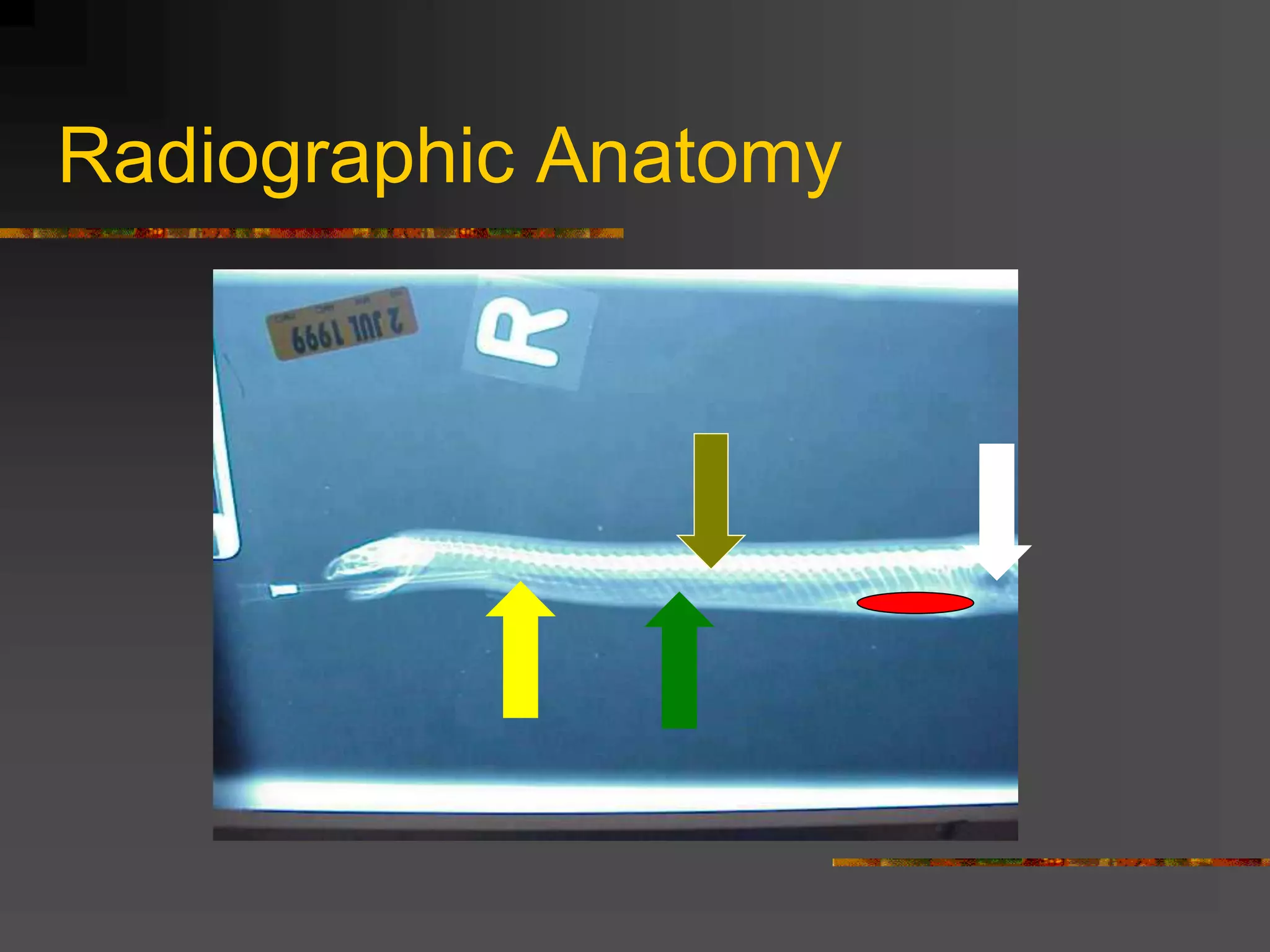 Radiographic Anatomy
 
